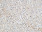 PKC α Polyclonal Antibody